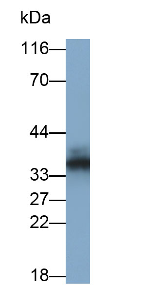 Polyclonal Antibody to Basic Salivary Proline Rich Protein 2 (PRB2)