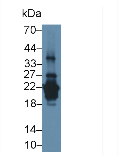 Polyclonal Antibody to Acidic Salivary Proline Rich Phosphoprotein 2 (PRH2)