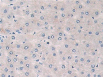 Polyclonal Antibody to Phospholipase A2, Group X (PLA2G10)