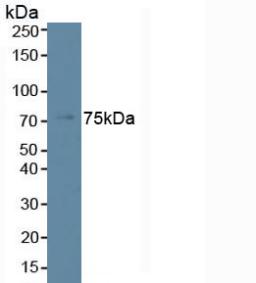 Polyclonal Antibody to Phospholipase C Beta 2 (PLCb2)