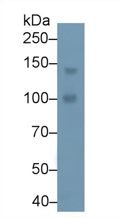 Polyclonal Antibody to Phospholipase C Beta 4 (PLCb4)