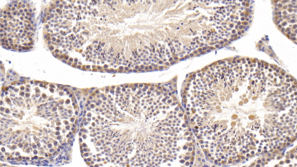 Polyclonal Antibody to Phospholipase C Delta 1 (PLCd1)