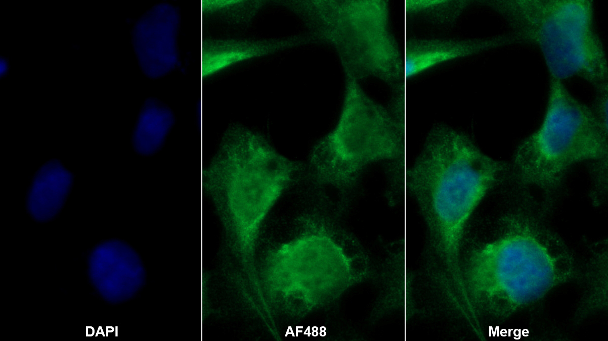 Polyclonal Antibody to Phospholipase C Delta 4 (PLCd4)