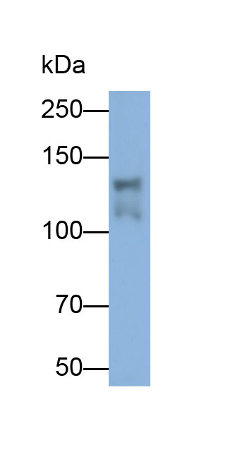 Polyclonal Antibody to Phospholipase C Gamma 2, Phosphatidylinositol Specific (PLCg2)