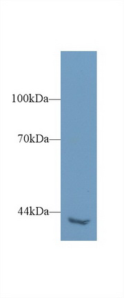 Polyclonal Antibody to Phospholipase C Eta 2 (PLCh2)