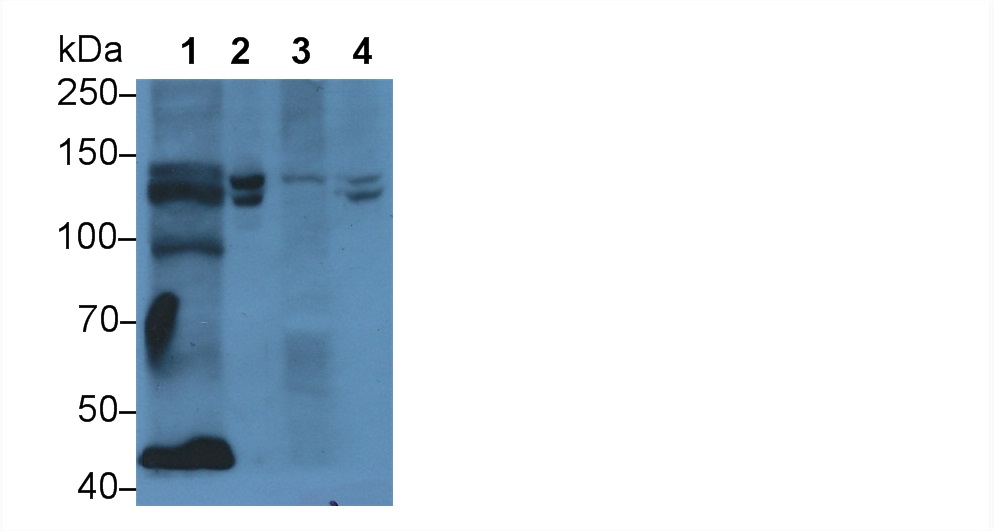 Polyclonal Antibody to Phospholipase C Like Protein 1 (PLCL1)