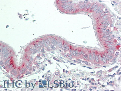 Polyclonal Antibody to Phospholipase A2 Receptor 1 (PLA2R1)