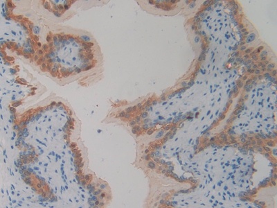 Polyclonal Antibody to Phospholipase A2 Receptor 1 (PLA2R1)