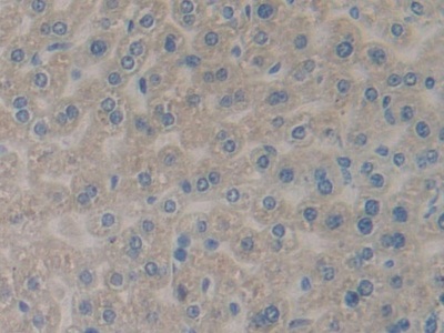 Polyclonal Antibody to Phospholipase A2 Receptor 1 (PLA2R1)