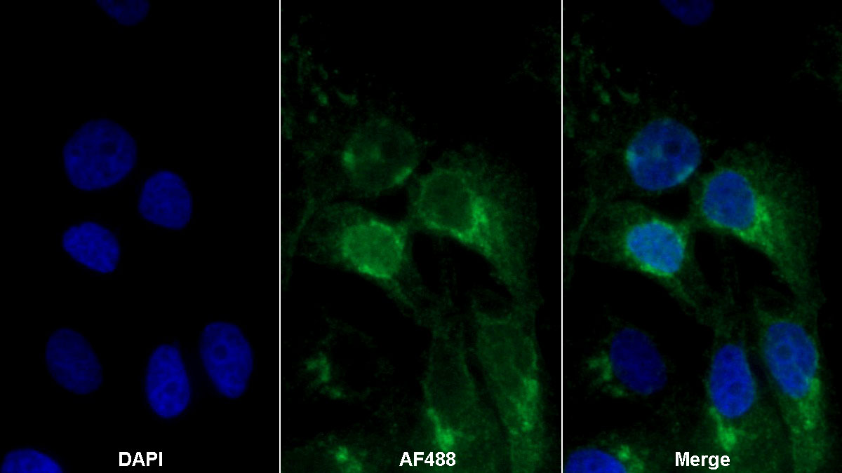 Polyclonal Antibody to Dynamin 3 (DNM3)