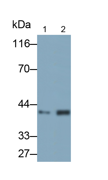 Polyclonal Antibody to Aspartate Aminotransferase 2 (AST2)