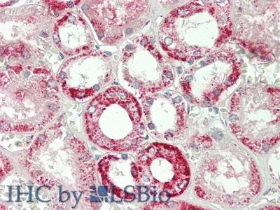 Polyclonal Antibody to Aspartate Aminotransferase 2 (AST2)