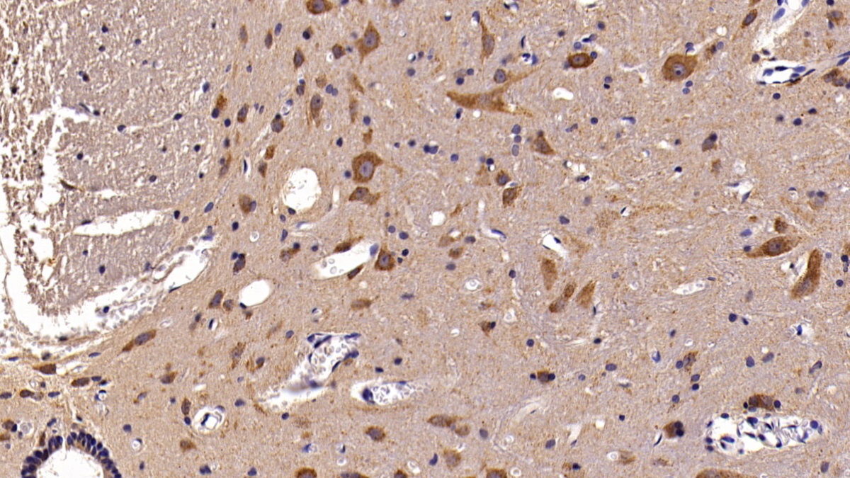 Polyclonal Antibody to Aspartate Aminotransferase 2 (AST2)