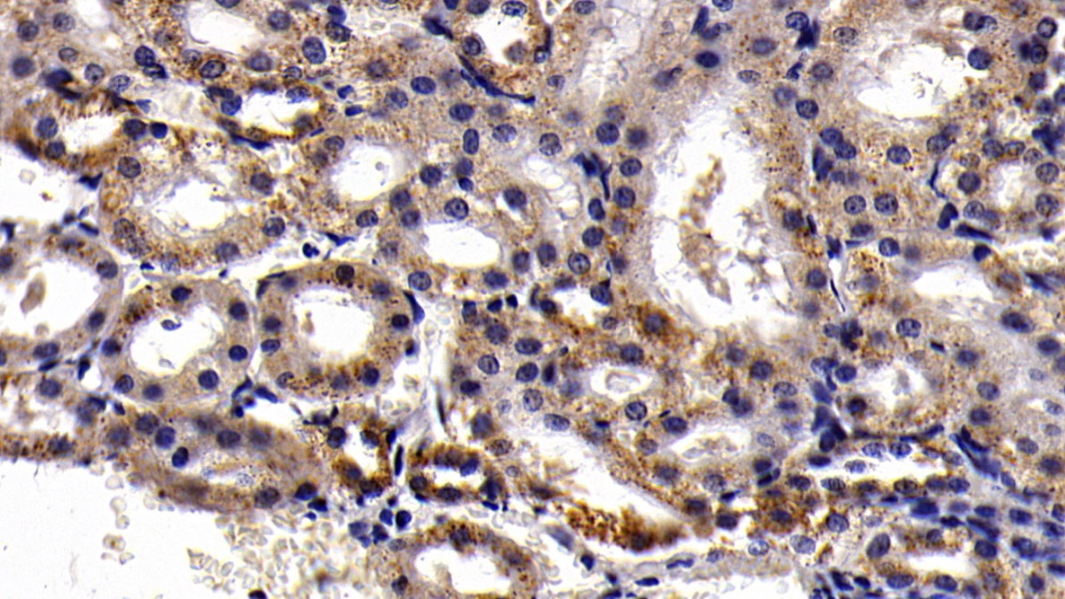 Polyclonal Antibody to Aspartate Aminotransferase 2 (AST2)