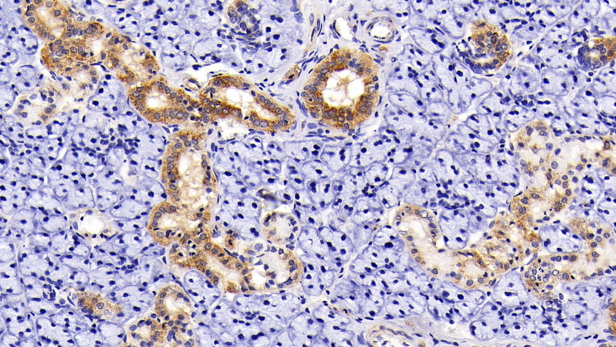 Polyclonal Antibody to Aspartate Aminotransferase 2 (AST2)