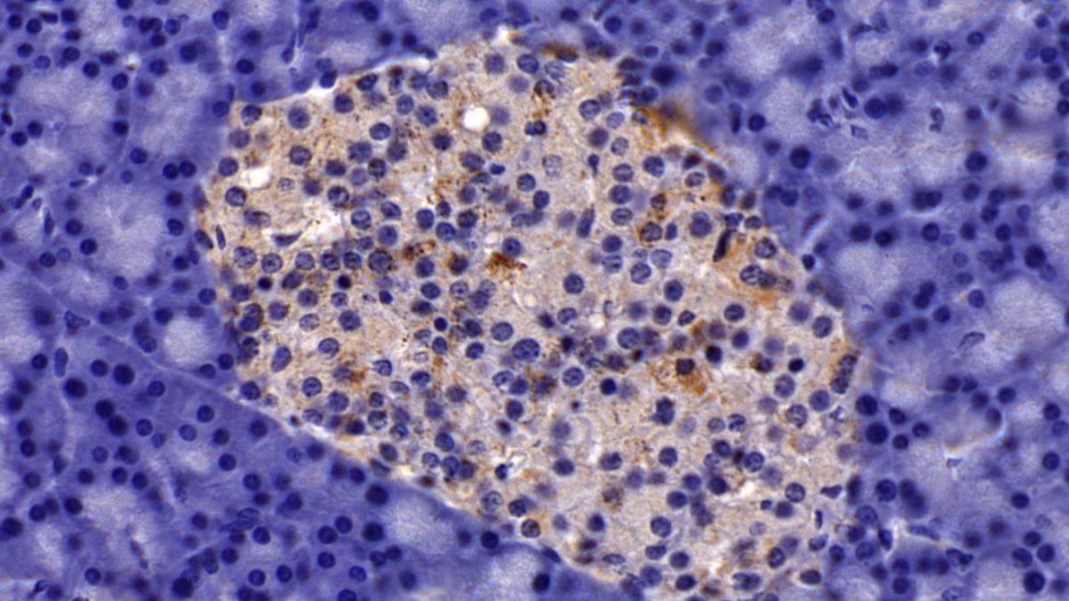 Polyclonal Antibody to Aspartate Aminotransferase 2 (AST2)