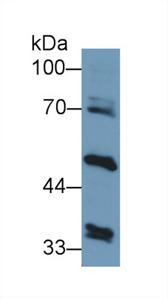 Polyclonal Antibody to Alanine Aminotransferase 2 (ALT2)