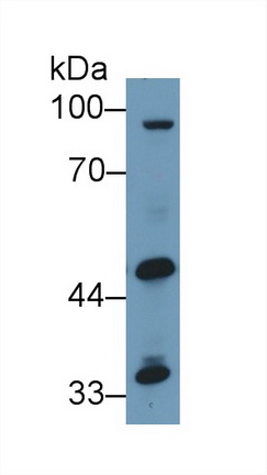 Polyclonal Antibody to Alanine Aminotransferase 2 (ALT2)