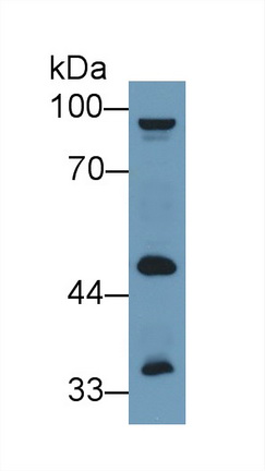 Polyclonal Antibody to Alanine Aminotransferase 2 (ALT2)