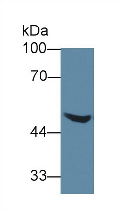 Polyclonal Antibody to Alanine Glyoxylate Aminotransferase 2 (AGXT2)