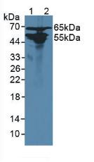 Polyclonal Antibody to Alanine Glyoxylate Aminotransferase 2 (AGXT2)