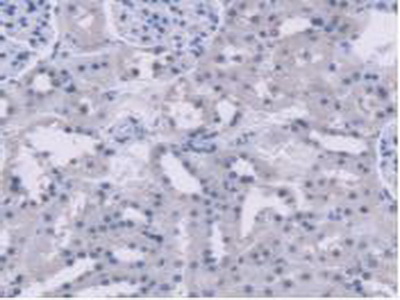 Polyclonal Antibody to Alanine Glyoxylate Aminotransferase 2 (AGXT2)