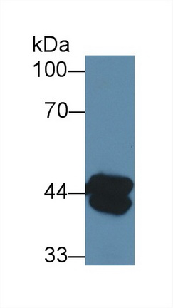 Polyclonal Antibody to Aminoadipate Aminotransferase (AADAT)