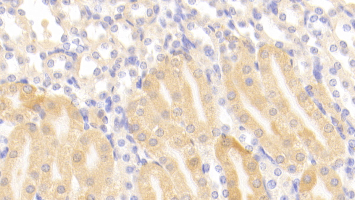 Polyclonal Antibody to Aminoadipate Aminotransferase (AADAT)