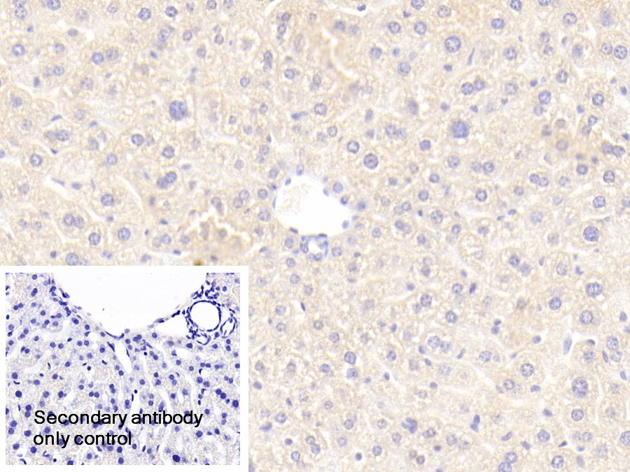 Polyclonal Antibody to Aminoadipate Aminotransferase (AADAT)