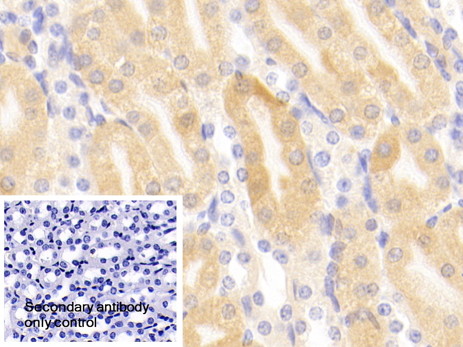 Polyclonal Antibody to Aminoadipate Aminotransferase (AADAT)