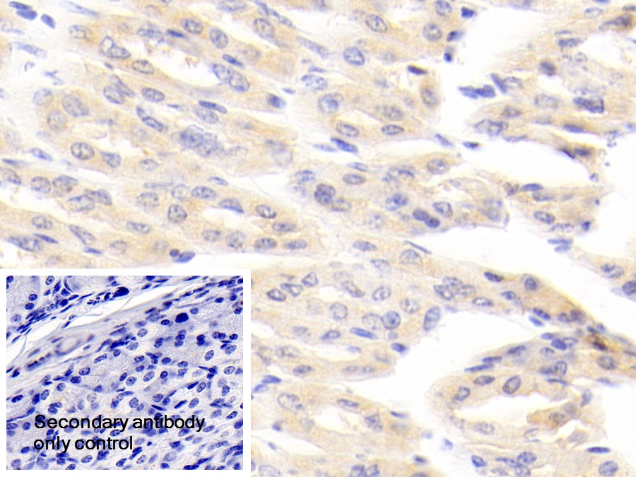 Polyclonal Antibody to Aminoadipate Aminotransferase (AADAT)