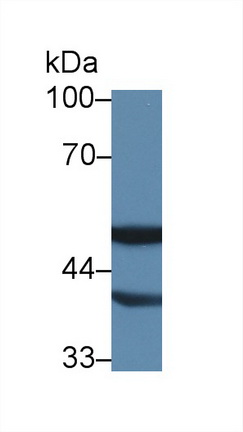 Polyclonal Antibody to 4-Aminobutyrate Aminotransferase (ABAT)