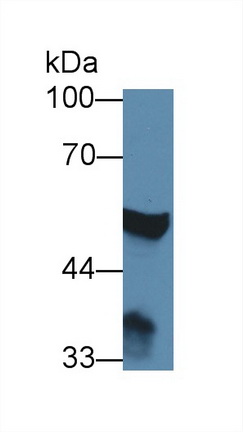 Polyclonal Antibody to 4-Aminobutyrate Aminotransferase (ABAT)