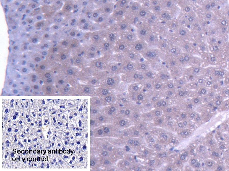 Polyclonal Antibody to 4-Aminobutyrate Aminotransferase (ABAT)