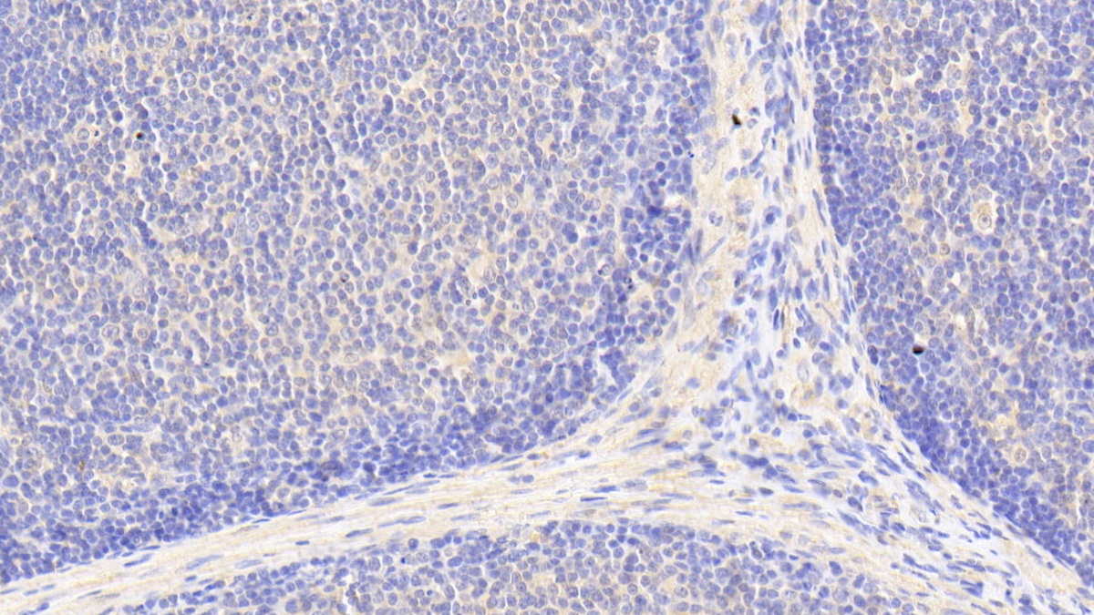 Polyclonal Antibody to Branched Chain Aminotransferase 1, Cytosolic (BCAT1)