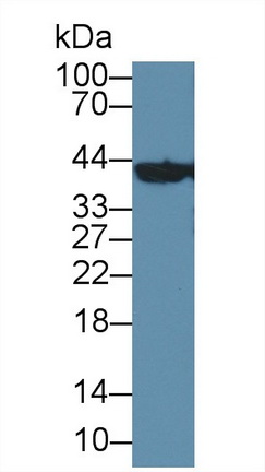 Polyclonal Antibody to Branched Chain Aminotransferase 1, Cytosolic (BCAT1)