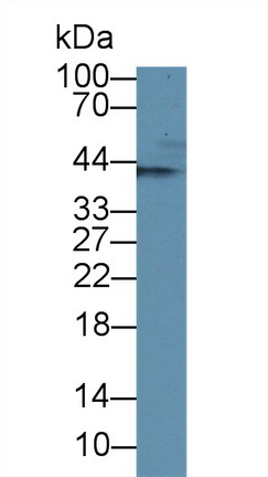 Polyclonal Antibody to Branched Chain Aminotransferase 1, Cytosolic (BCAT1)