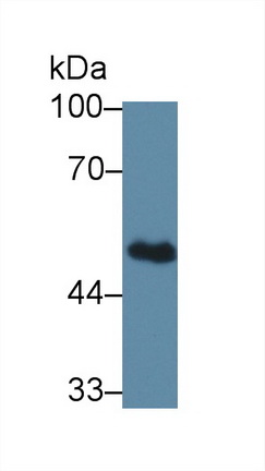 Polyclonal Antibody to Branched Chain Aminotransferase 1, Cytosolic (BCAT1)