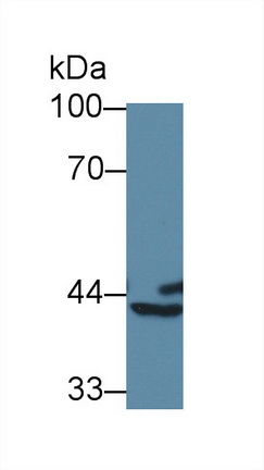 Polyclonal Antibody to Branched Chain Aminotransferase 1, Cytosolic (BCAT1)