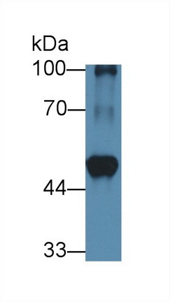 Polyclonal Antibody to Branched Chain Aminotransferase 1, Cytosolic (BCAT1)