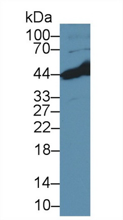 Polyclonal Antibody to Branched Chain Aminotransferase 2, Mitochondrial (BCAT2)