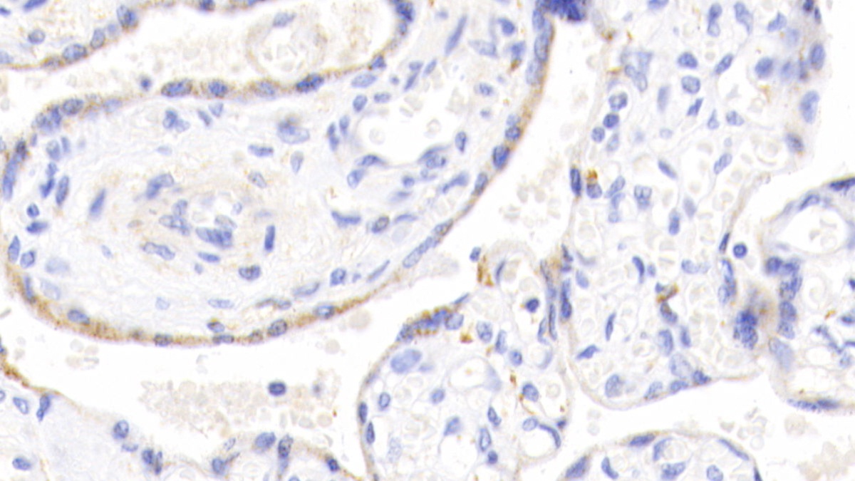 Polyclonal Antibody to Branched Chain Aminotransferase 2, Mitochondrial (BCAT2)