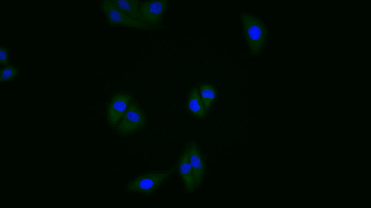 Polyclonal Antibody to Branched Chain Aminotransferase 2, Mitochondrial (BCAT2)