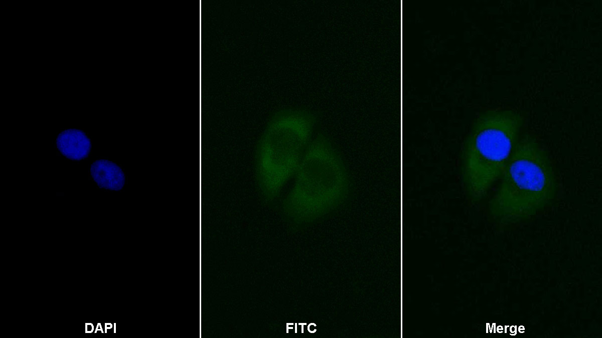 Polyclonal Antibody to Branched Chain Aminotransferase 2, Mitochondrial (BCAT2)