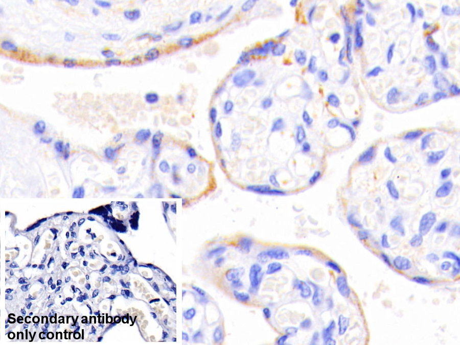 Polyclonal Antibody to Branched Chain Aminotransferase 2, Mitochondrial (BCAT2)