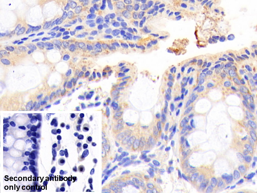 Polyclonal Antibody to Branched Chain Aminotransferase 2, Mitochondrial (BCAT2)