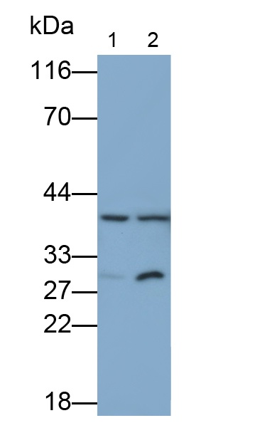 Polyclonal Antibody to Branched Chain Aminotransferase 2, Mitochondrial (BCAT2)