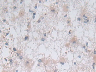 Polyclonal Antibody to Ornithine Aminotransferase (OAT)