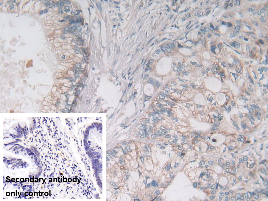 Polyclonal Antibody to Ornithine Aminotransferase (OAT)