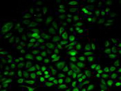 Polyclonal Antibody to Phosphoserine Aminotransferase 1 (PSAT1)